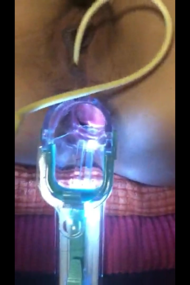 某SM論壇流出國產超變態重口味女奴調教堪比周曉琳和紫竹鈴陰道注射尿內窺鏡開肛往裡撒尿塞奶油在拉出來國語對白